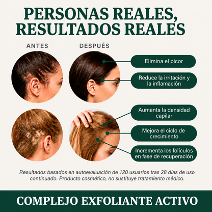 Exfoliante Capilar Natural
